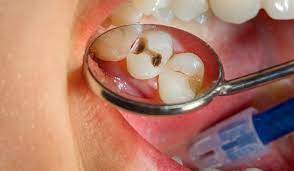 Ağız Diş ve Çene Cerrahisi