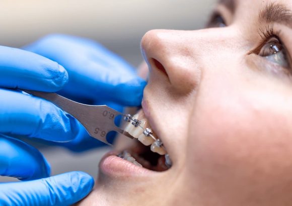 Beylikdüzü Ortodonti, Beylikdüzü Ortodontist