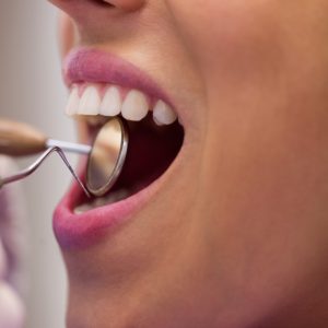 Diş Aşınması Nedir? Diş Aşınması Nasıl Önlenir?